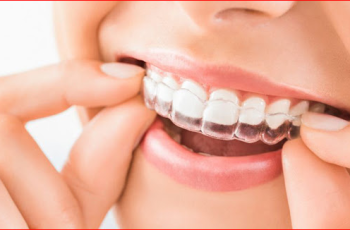 Is Invisalign Covered Under Dental Protection?
